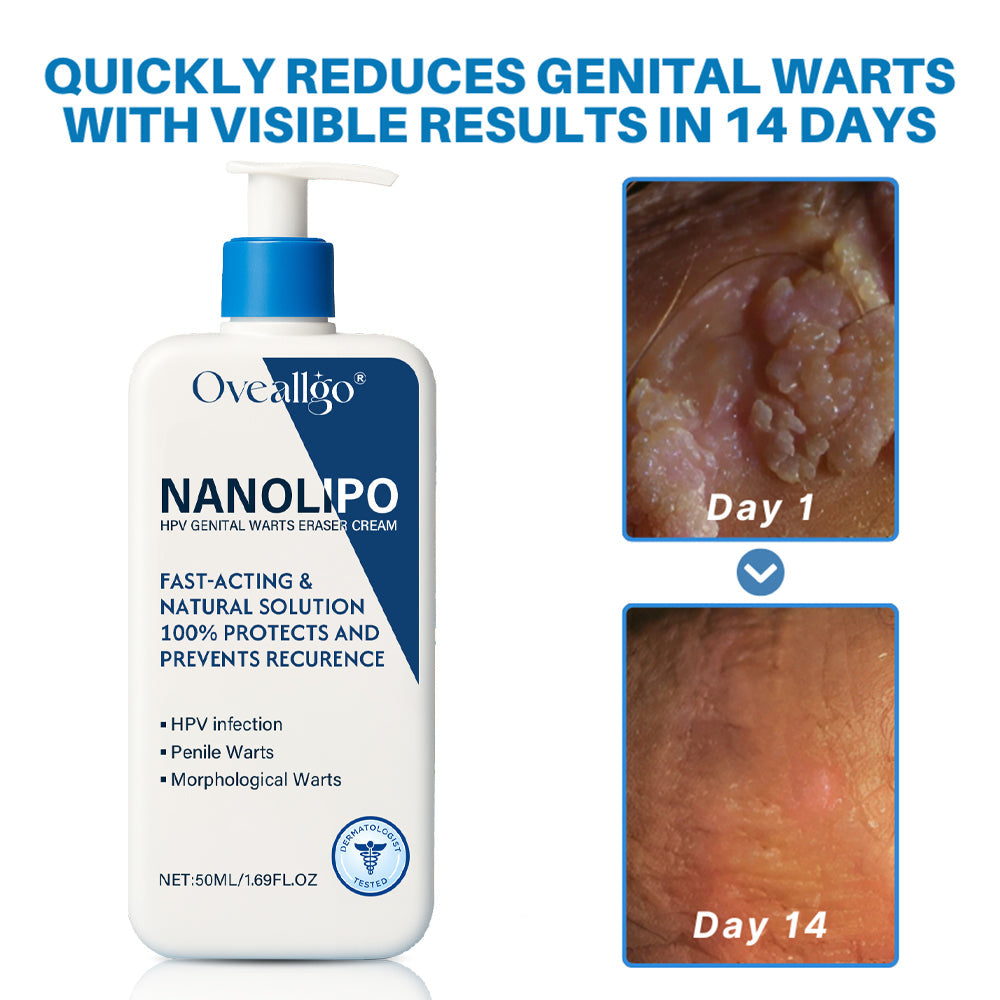 Qvedfo® NanoLipo HPV Genital Warts Eraser Cream Prox