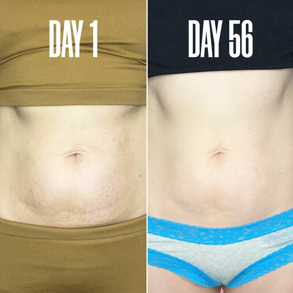 Final 3 hours-60%OFF🔥The Skin-Smoothing Duo Tightens, Firms, And Smooths The Look Of The Skin.