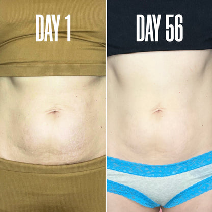 Final 3 hours-60%OFF🔥The Skin-Smoothing Duo Tightens, Firms, And Smooths The Look Of The Skin.