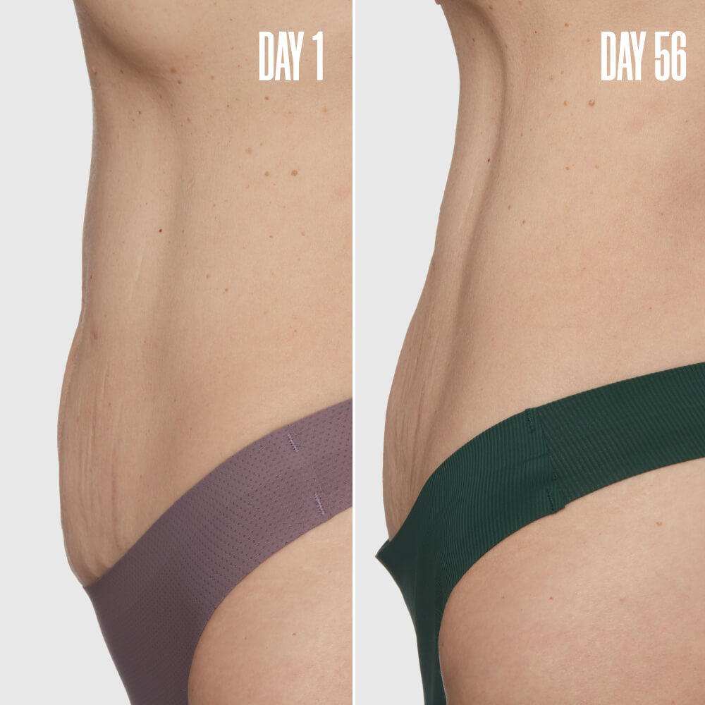 Final 3 hours-60%OFF🔥The Skin-Smoothing Duo Tightens, Firms, And Smooths The Look Of The Skin.