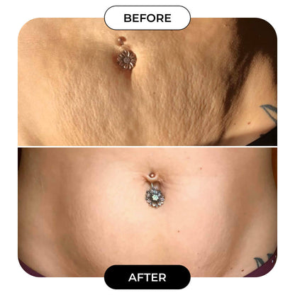 Final 3 hours-60%OFF🔥The Skin-Smoothing Duo Tightens, Firms, And Smooths The Look Of The Skin.