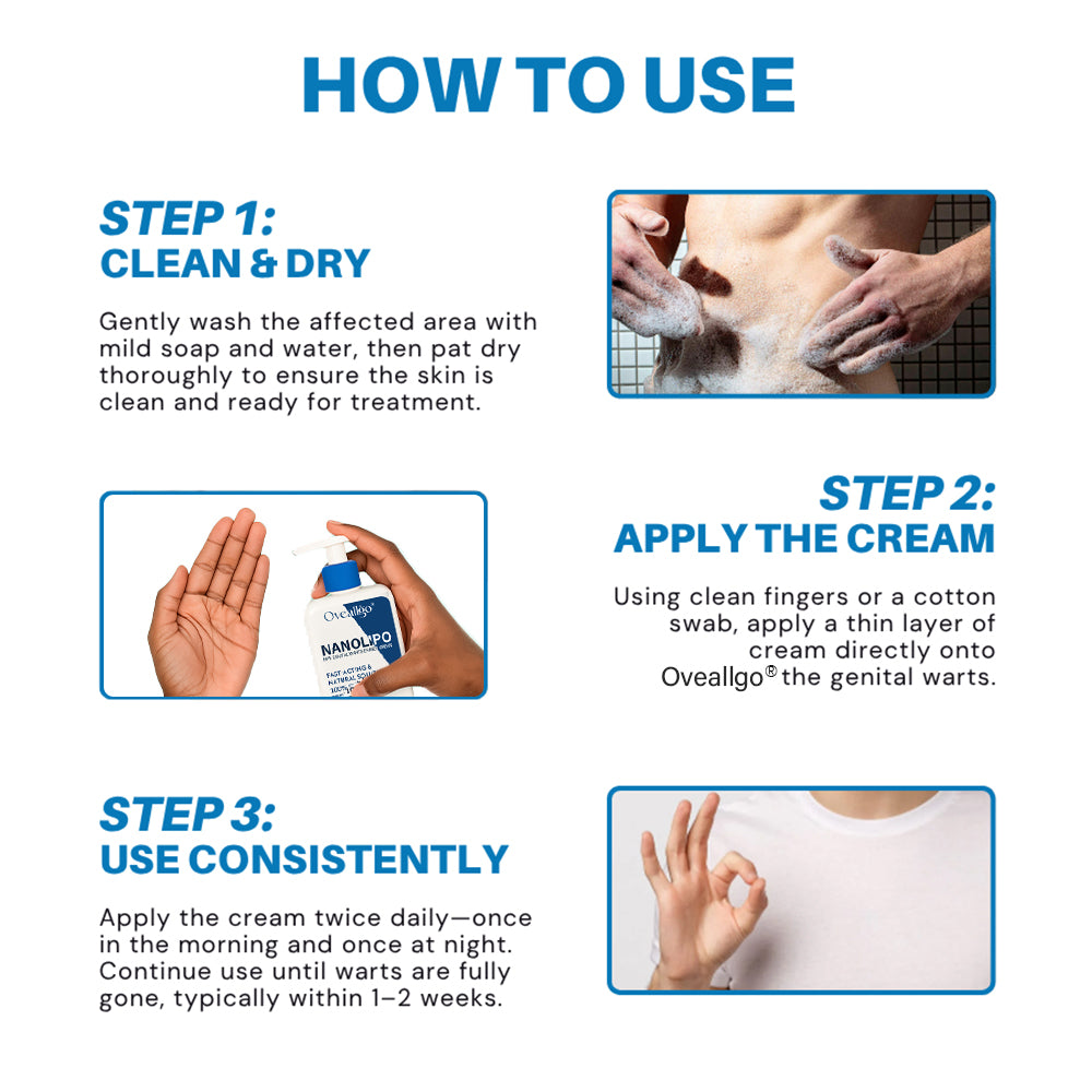 Qvedfo® NanoLipo HPV Genital Warts Eraser Cream Prox